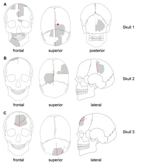 Gráfico de los cráneos. En rojo las modificaciones. En gris, los elementos preservados