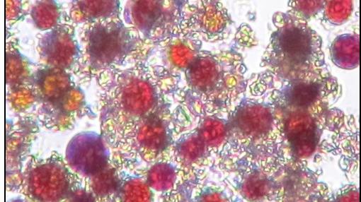 Algas de nieve bajo el microscopio