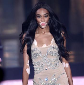 Winnie Harlow inviitada en la gala de benéfica