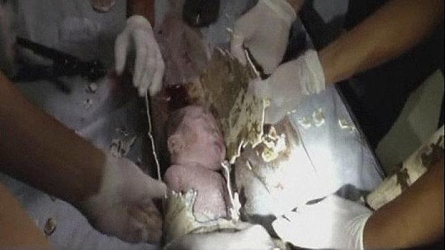 Rescatan de una tubería a un bebé al que sus padres arrojaron por el retrete
