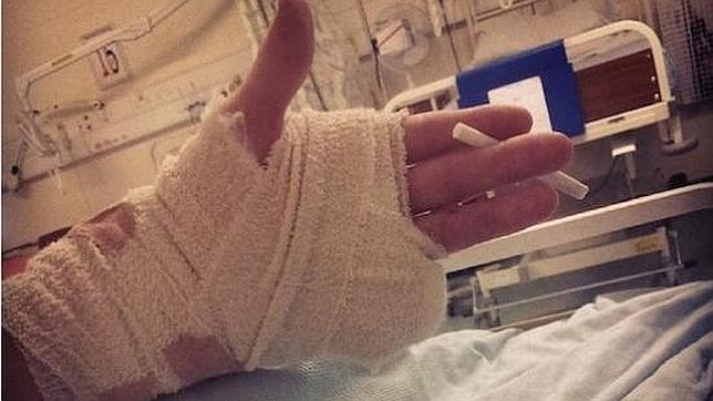 Pierde un dedo en una «rave» y sigue de fiesta