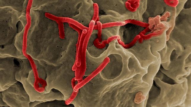 Microfotografía del virus ébola sobre una célula de mono verde africano