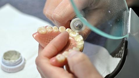 Si no se cuidan correctamente, los implantes pueden durar menos de lo previsto