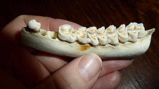 Caries en un esqueleto