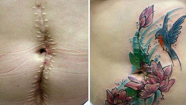 La Mujer Que Regala Tatuajes Para Cubrir Cicatrices De Violencia De