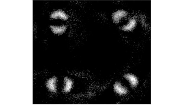 Esta es una de las imágenes obtenidas por los investigadores de la Universidad de Glasgow