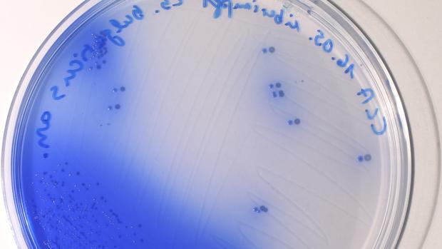 Lactobacillus bulgaricus