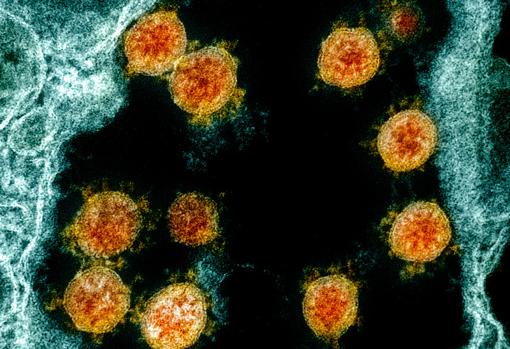 Photomicrograph of various SARS-CoV-2 particles (in orange)