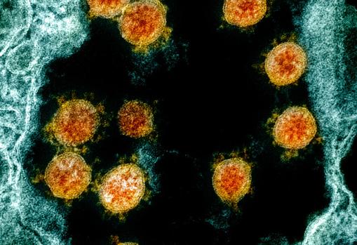 Microfotografía electrónica de transmisión de partículas de SARS-CoV-2 (en naranja), aisladas de un paciente, y obtenida en el IRF, en Fort Detrick, Maryland (EE.UU.)