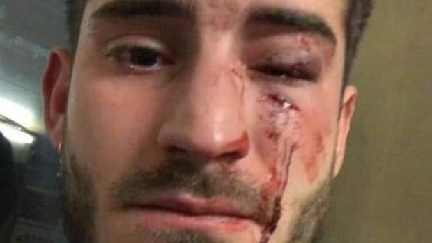 El joven ha compartido en redes sociales las heridas que le ha causado la brutal agresión