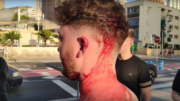 Imagen del agredido en un momento del vídeo