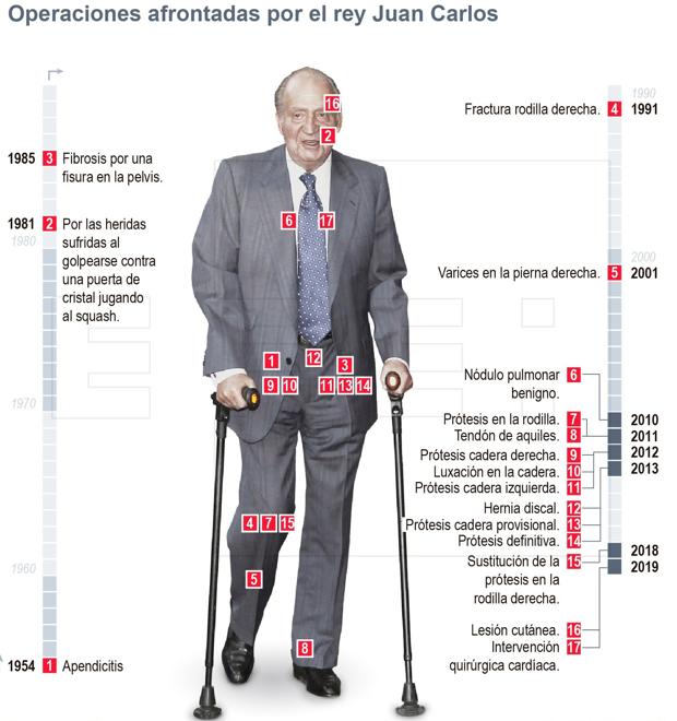 Infografía de todas las operaciones a las que se ha sometido Don Juan Carlos