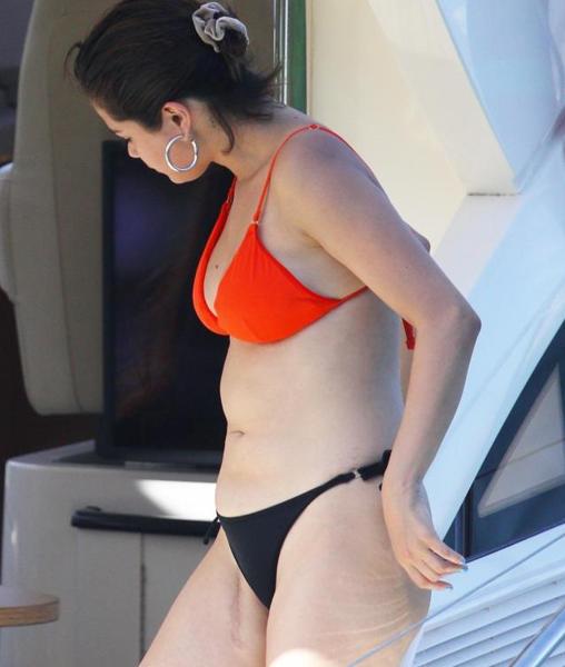 Cicatriz de Selena Gomez