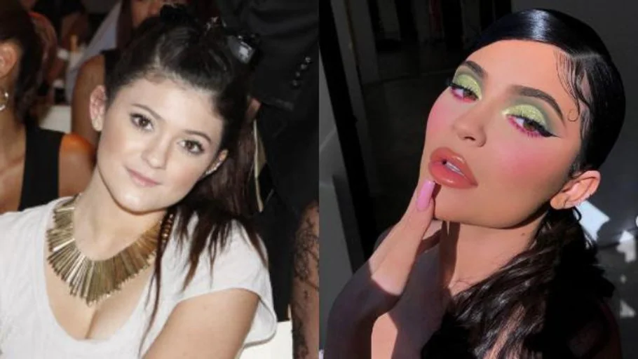 Kylie Jenner Cumple 22: Así Es Su Aspecto Después De Innumerables ...