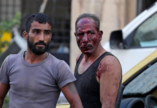 Un hombre con el rostro ensangrentado tras la explosión en Beirut
