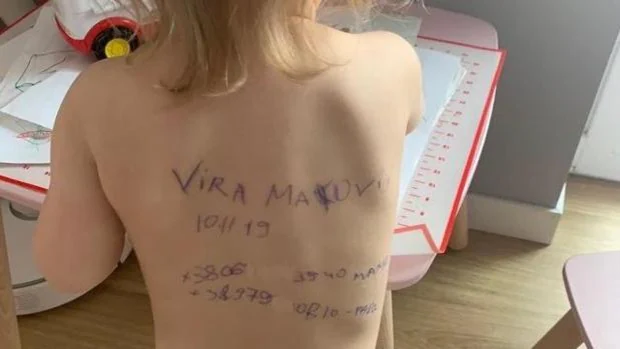 La espalda de Vira, una niña de dos años y medio, con los datos de contacto su familia