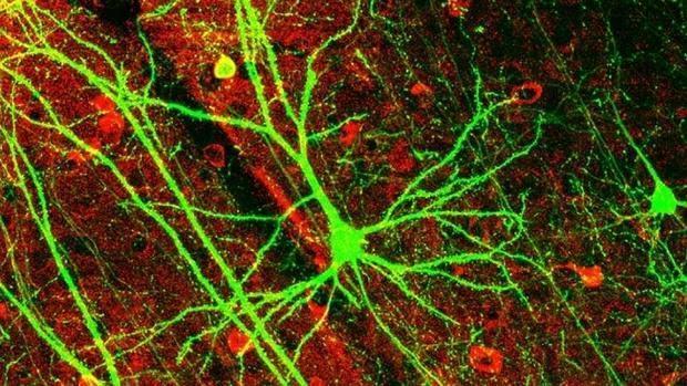 Neuronas