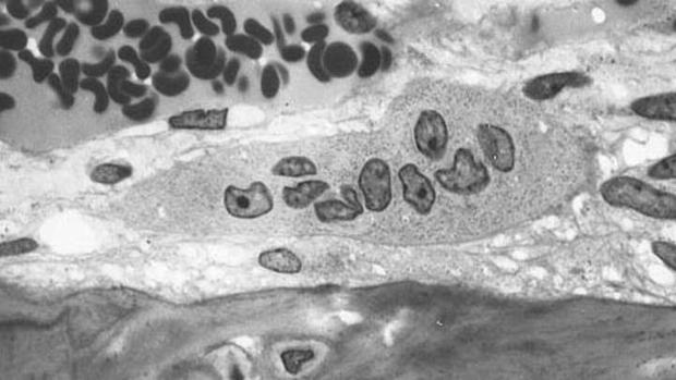 Los osteoclastos son las células responsables de la destrucción del tejido óseo