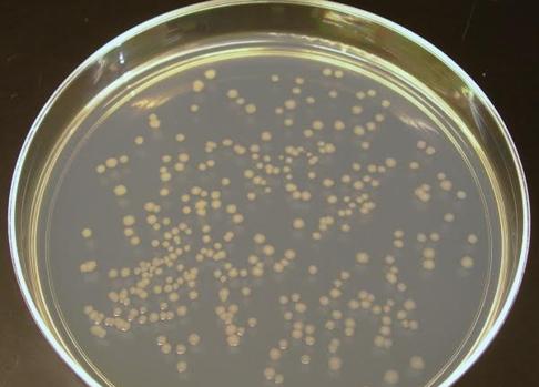 Cultivo bacteriano en una placa de laboratorio