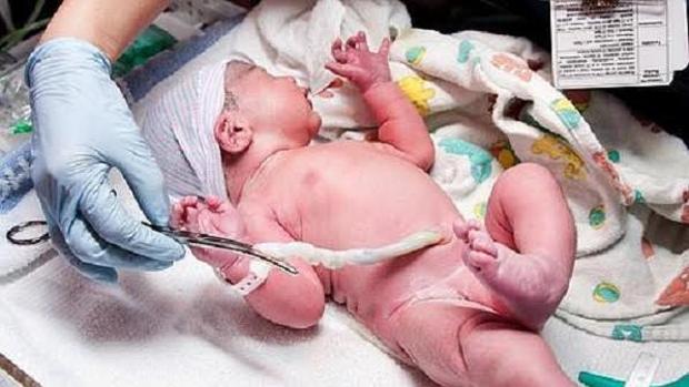 El cordón umbilical es una fuente rica en células madre