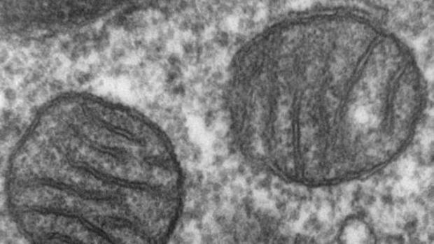 enfermedad mitocondrial diabetes tipo 1