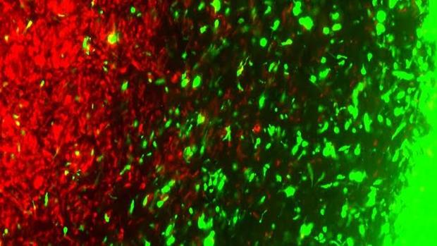 Células tumorales genéticamente editadas (en verde) se dirigien hacia las células de cáncer cerebral (en rojo)