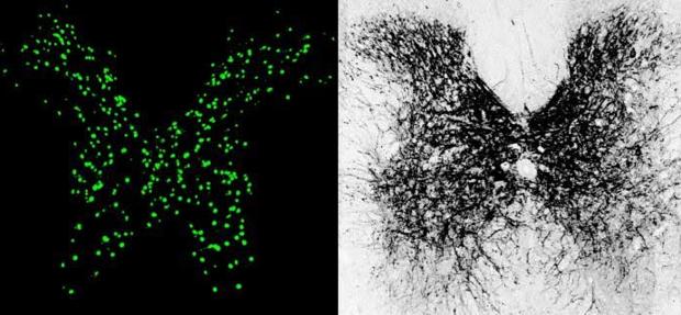 Incremento de la expresión de KCC2 en las neuronas inhibitorias de la medula espinal de ratón (izquierda)