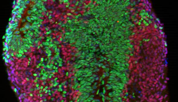 Organoide humano cortical