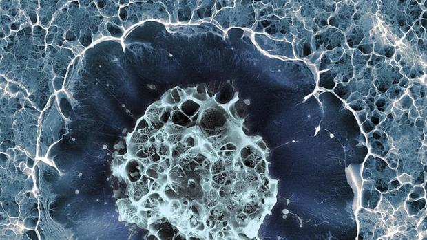 Células madre y terapias genéticas para la diabetes mellitus. Células madre y terapias genéticas para la diabetes mellitus.