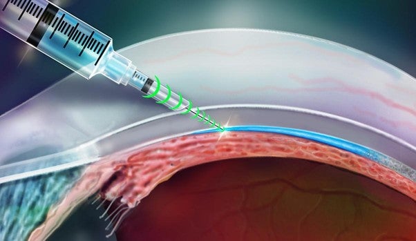 En las pruebas preclínicas, el inyector con sensor de resistencia permite a los investigadores entregar medicamentos de forma más segura y efectiva al cuerpo ver más