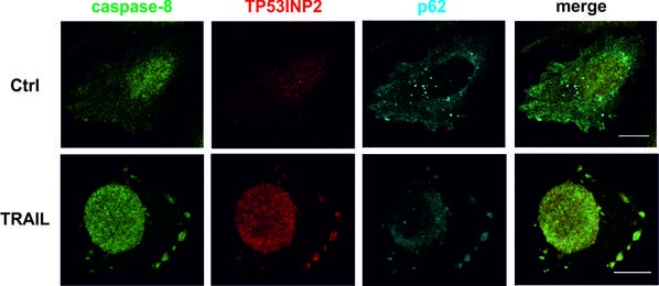 Diferentes localizaciones de las proteínas involucradas en apoptosis en condiciones basales (Ctrl) y con inducción de los receptores de muerte celular con TRAIL