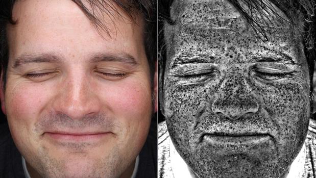 Los retratos ultravioleta permiten ver los daños invisibles del sol en la piel