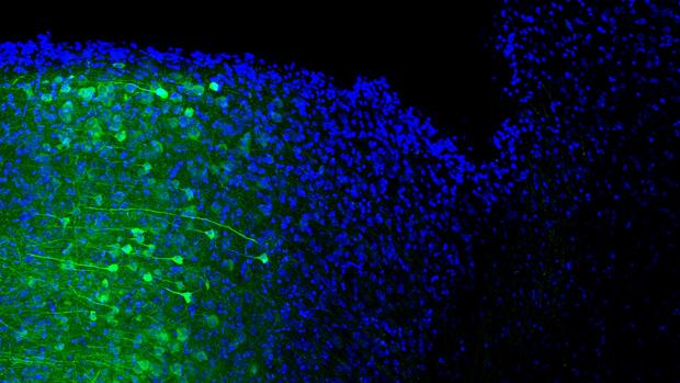 Núcleos (azul) de las neuronas de la corteza prefrontal medial que proyectan sus axones (verde) al área gris periacueductal.
