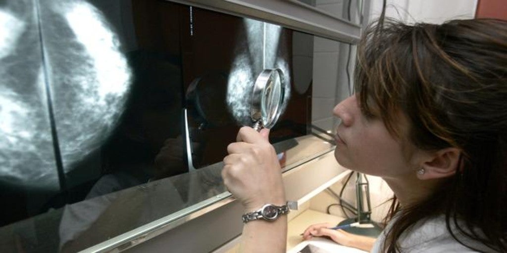 El tratamiento que podría evitar la quimioterapia en el cáncer de mama