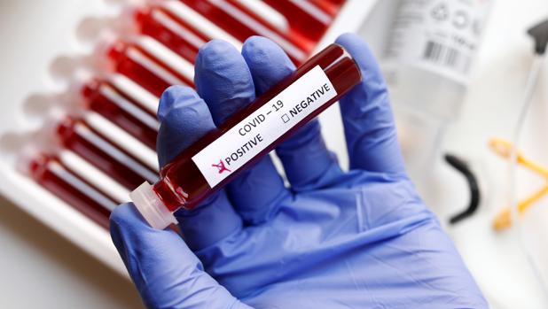 coronavirus-positivo2-k7sF--620x349@abc