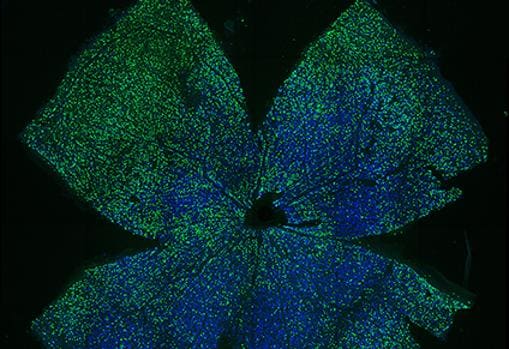 La retina de un ratón después de recibir la terapia del gen OSK.