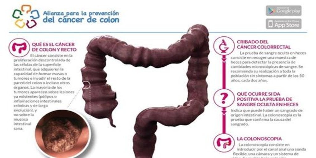 cancer colon heces ce medicament ucide paraziții din organism