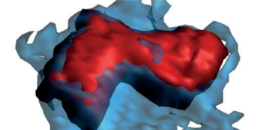 Neutrophil (in red) with behavior associated with cardiovascular damage.