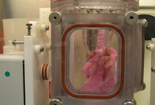 El nuevo órgano, en el biorreactor donde fue generado