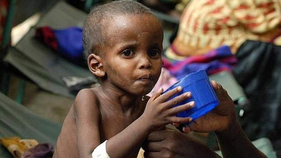 Unicef advierte de que uno de cada tres niños en el mundo está desnutrido u  obeso