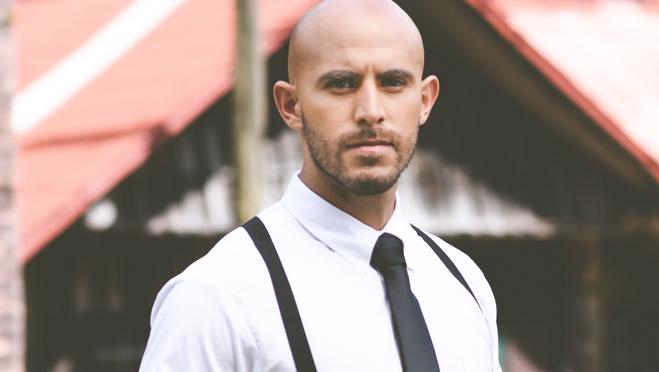 El 84% de la población masculina en España sufre alopecia