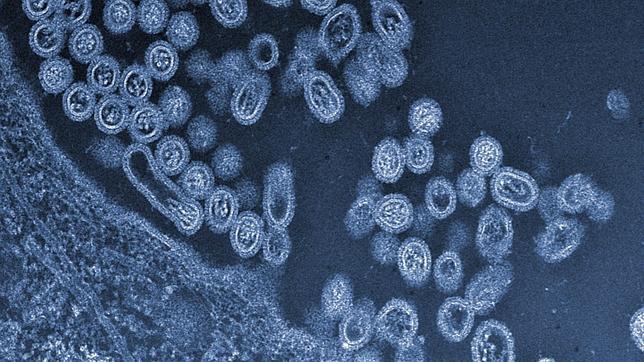 Imagen al microscopio del virus aviar HTN9